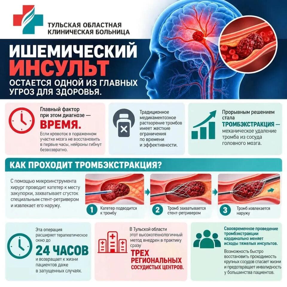 Все об инсульте