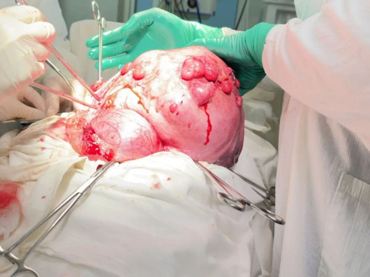 14 килограммов изменили жизнь тулячки