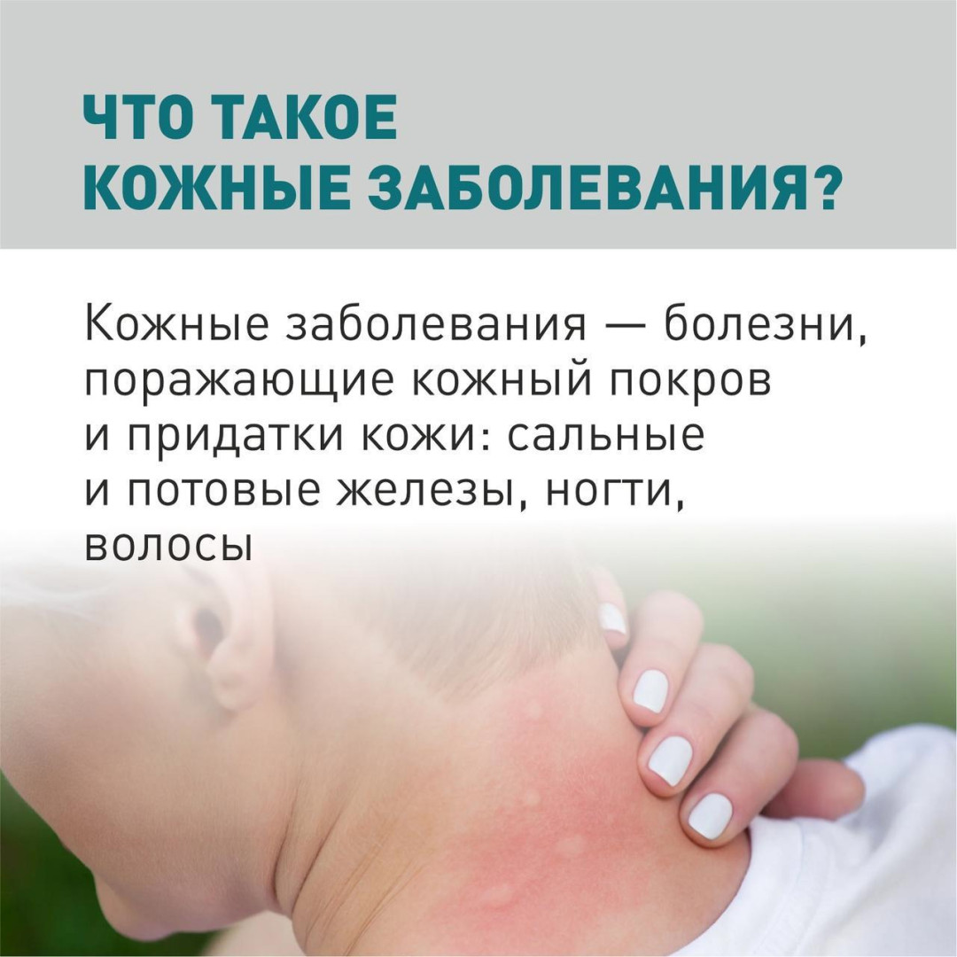 Неделя профилактики кожных заболеваний на период с 2 сентября по 8 сентября 2024 года