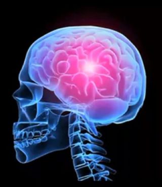 Неделя борьбы с инсультом (в честь Всемирного дня борьбы с инсультом 29 октября)