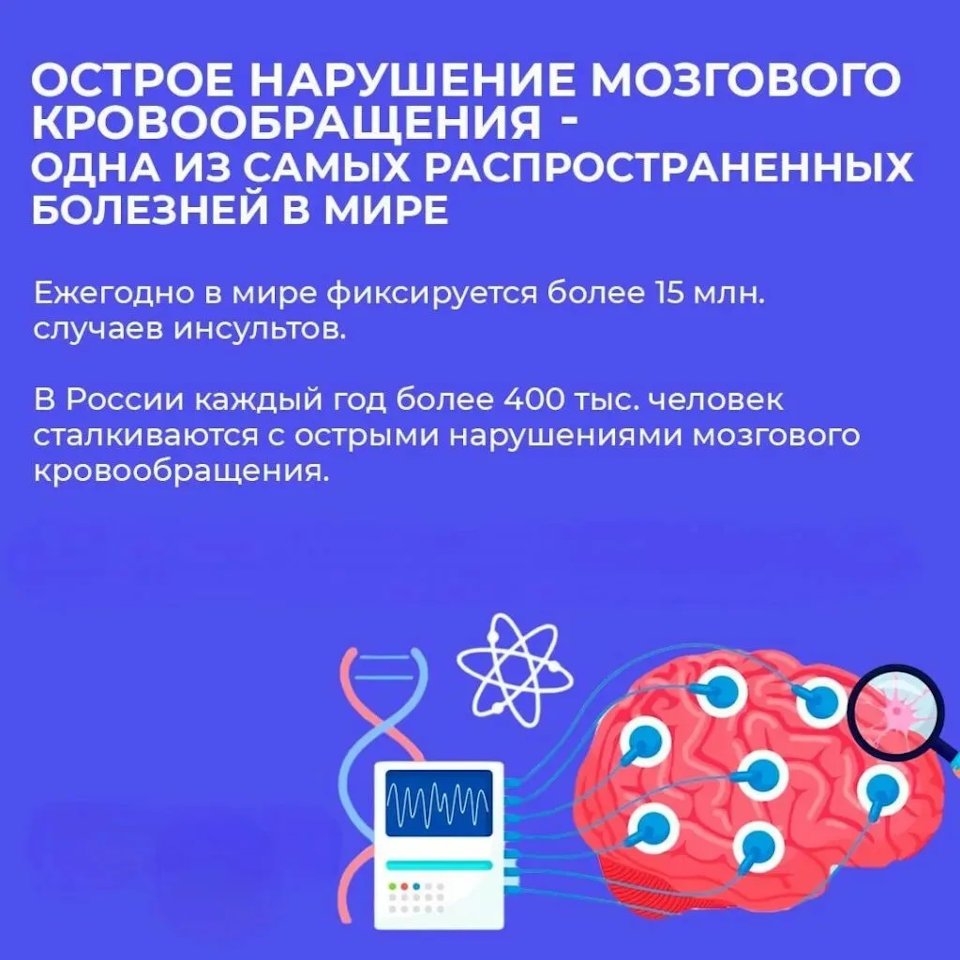 Острое нарушение мозгового кровообращения