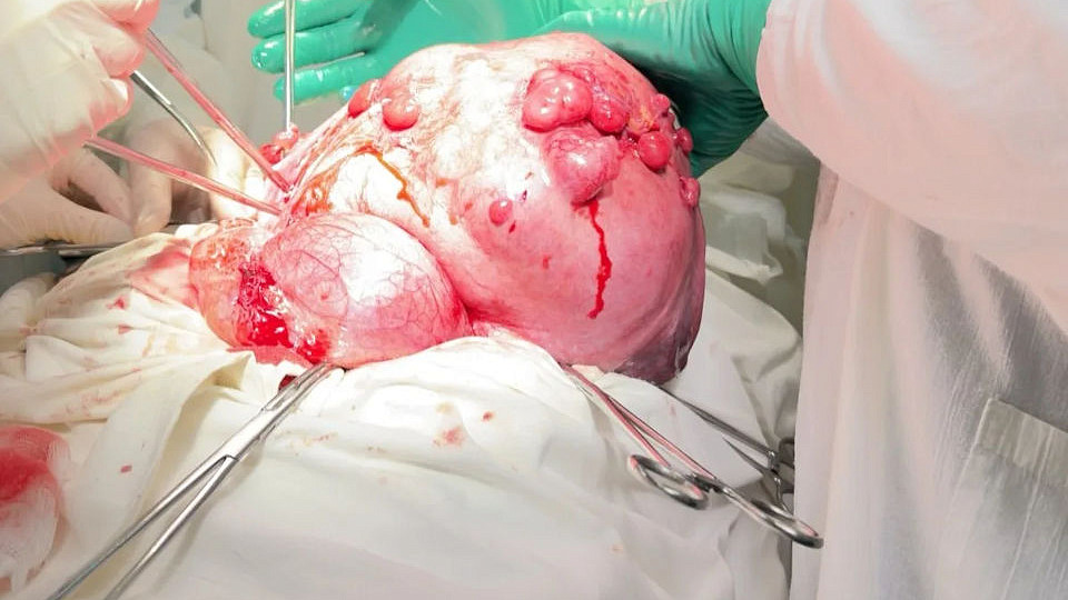 14 килограммов изменили жизнь тулячки